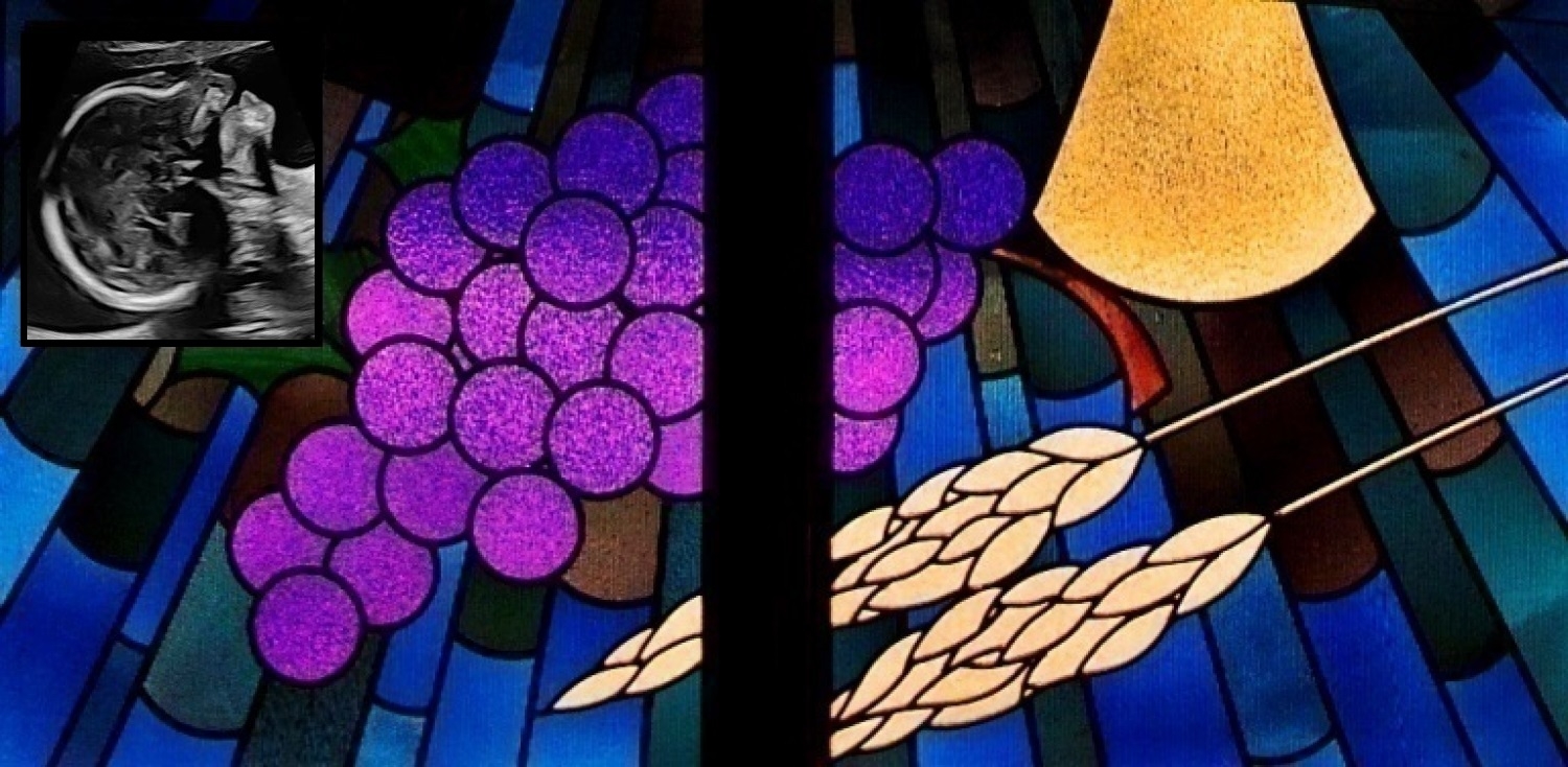 Kai Blake Grant-Mcnab Funeral Sermon - Jeremiah 31:15–17 June 21st 2022 / Hope for Your Future